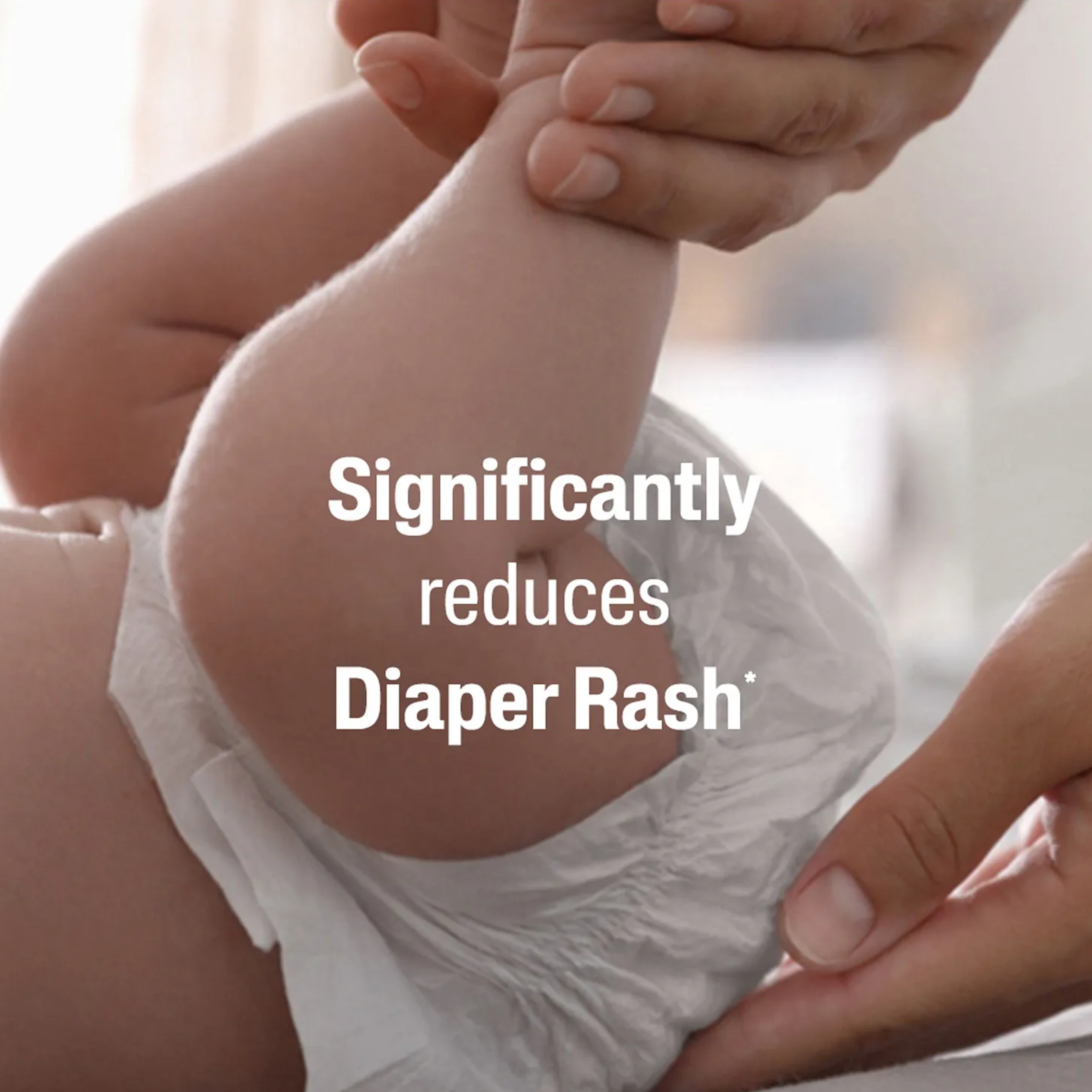 Cetaphil Baby Diaper Cream | Soothing & Protective Rash Cream for Newborns | Gentle Care for Sensitive Baby Skin-70g